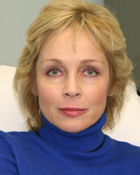 After Restylane