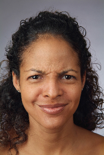Non-Surgical Procedures - Botox - Case #2088 Before