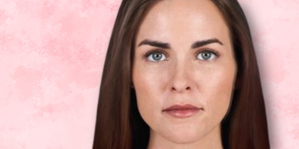 juvederm volbella xc